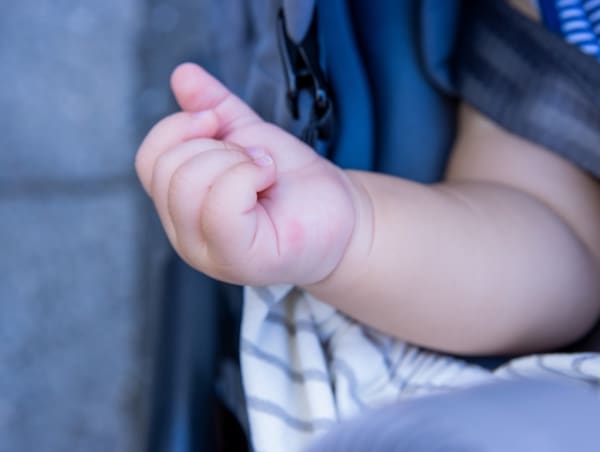虫に刺された赤ちゃんの手